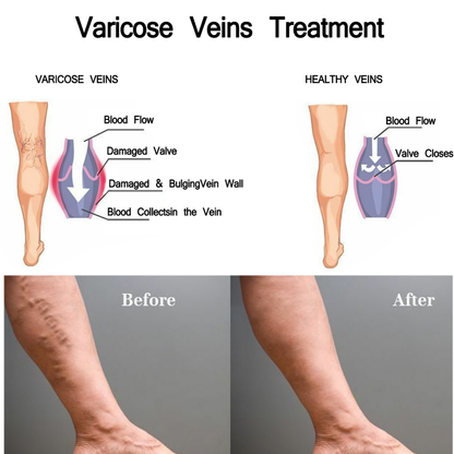 Leg Comfort Herbal Patches – Daily Support | Vital Woman