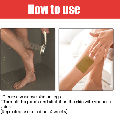 Leg Comfort Herbal Patches – Daily Support | Vital Woman